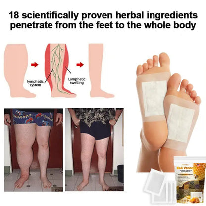 Bee Venom Lymphatic Drainage & Slimming Foot Patches 🌿