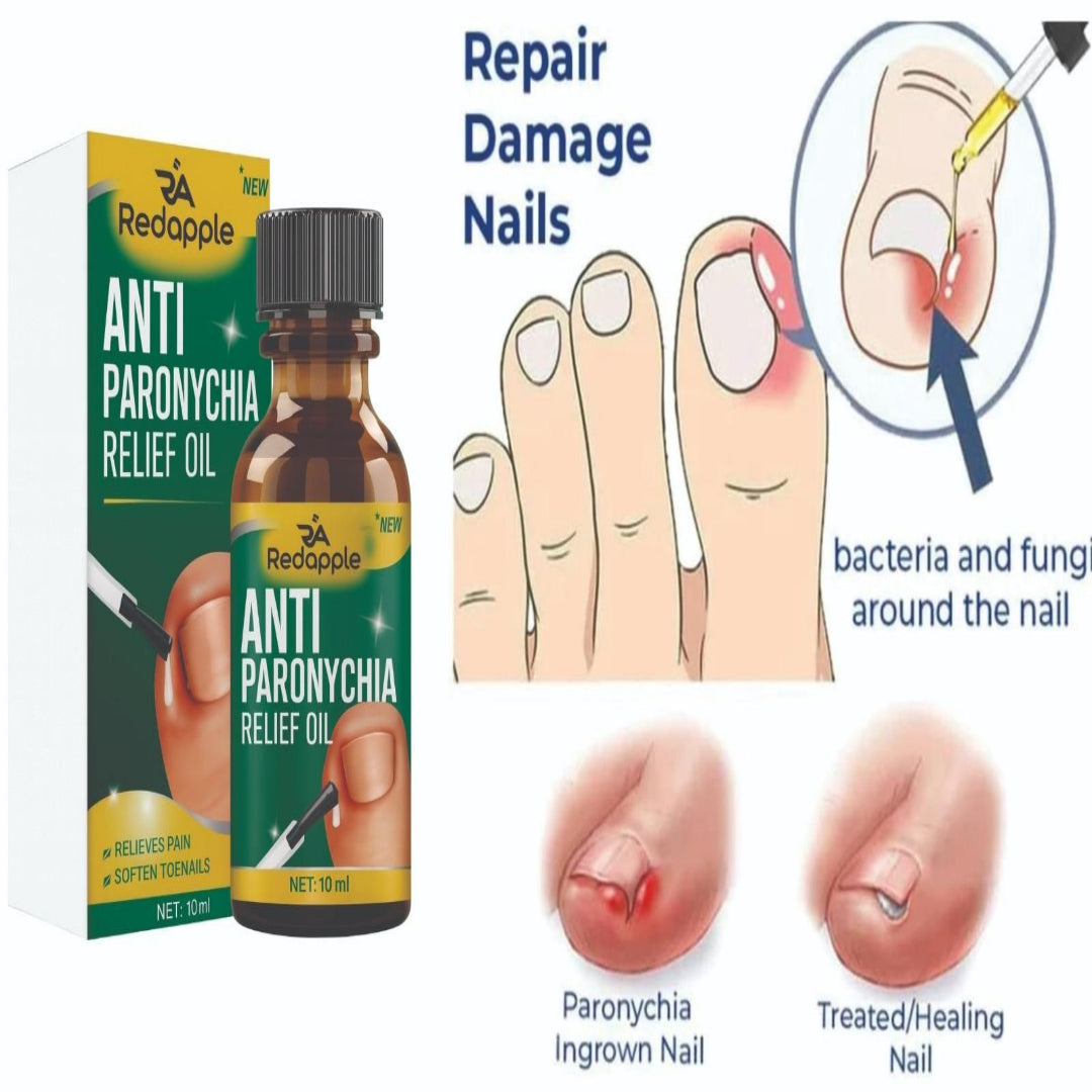 Anti Paronychia Relief Oil - (Buy 1 Get 1 FREE🔥🔥)