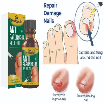 Anti Paronychia Relief Oil - (Buy 1 Get 1 FREE🔥🔥)